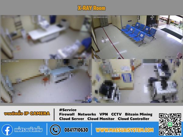 ติดตั้งกล้องวงจรปิด ห้อง X-RAY